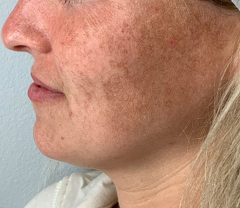 Rectangle 19 Rectangle 19