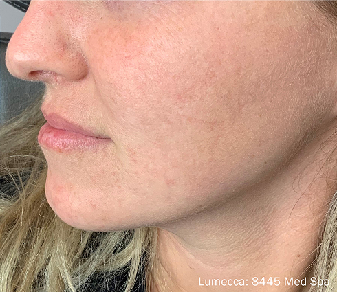 Rectangle 20 Rectangle 20