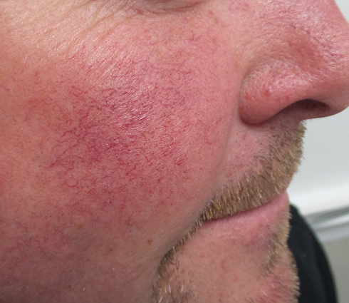 Rectangle 21 Rectangle 21