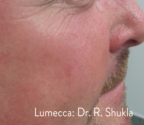 Rectangle 22 Rectangle 22