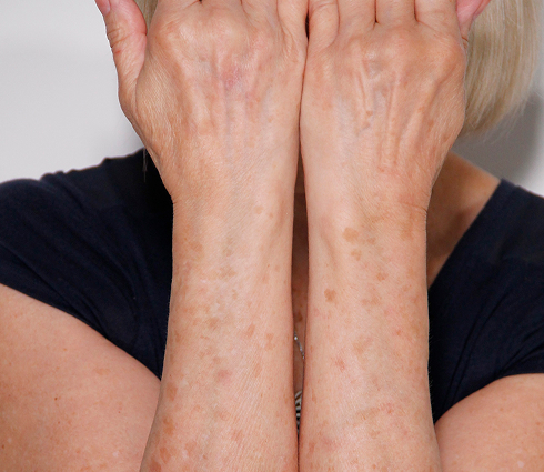 Rectangle 24 Rectangle 24