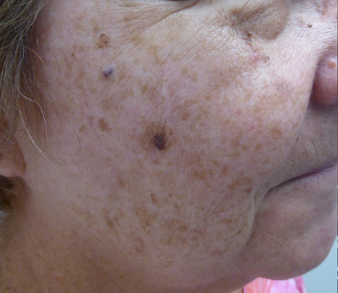 Rectangle 25 Rectangle 25