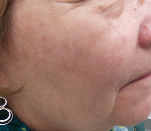 Rectangle 26 Rectangle 26