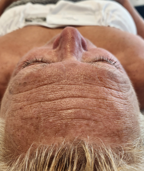 Rectangle 32 Rectangle 32