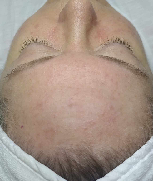 Rectangle 33 Rectangle 33