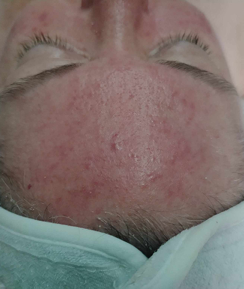 Rectangle 34 Rectangle 34