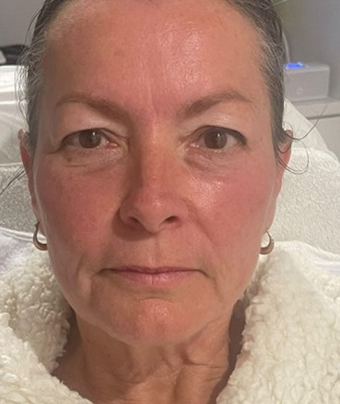 Rectangle 35 Rectangle 35