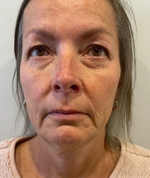 Rectangle 36 Rectangle 36