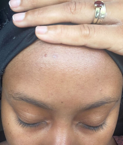 Rectangle 37 Rectangle 37