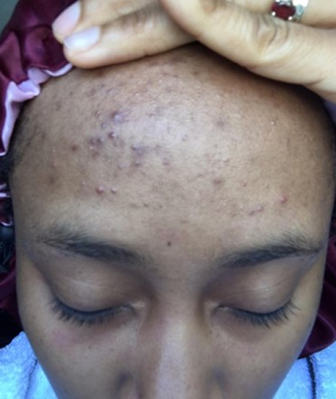 Rectangle 38 Rectangle 38