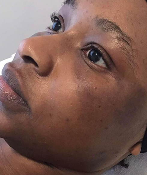 Rectangle 42 Rectangle 42